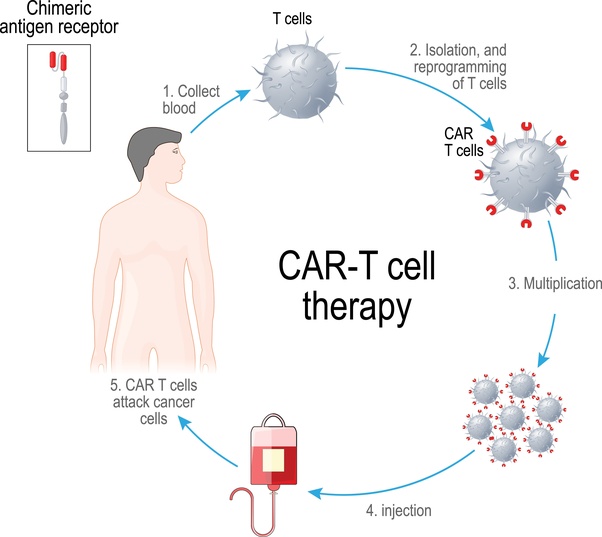 What is CART therapy? Quora