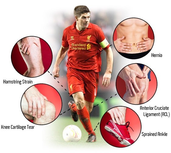 What are the common injuries to football (soccer) players? Quora
