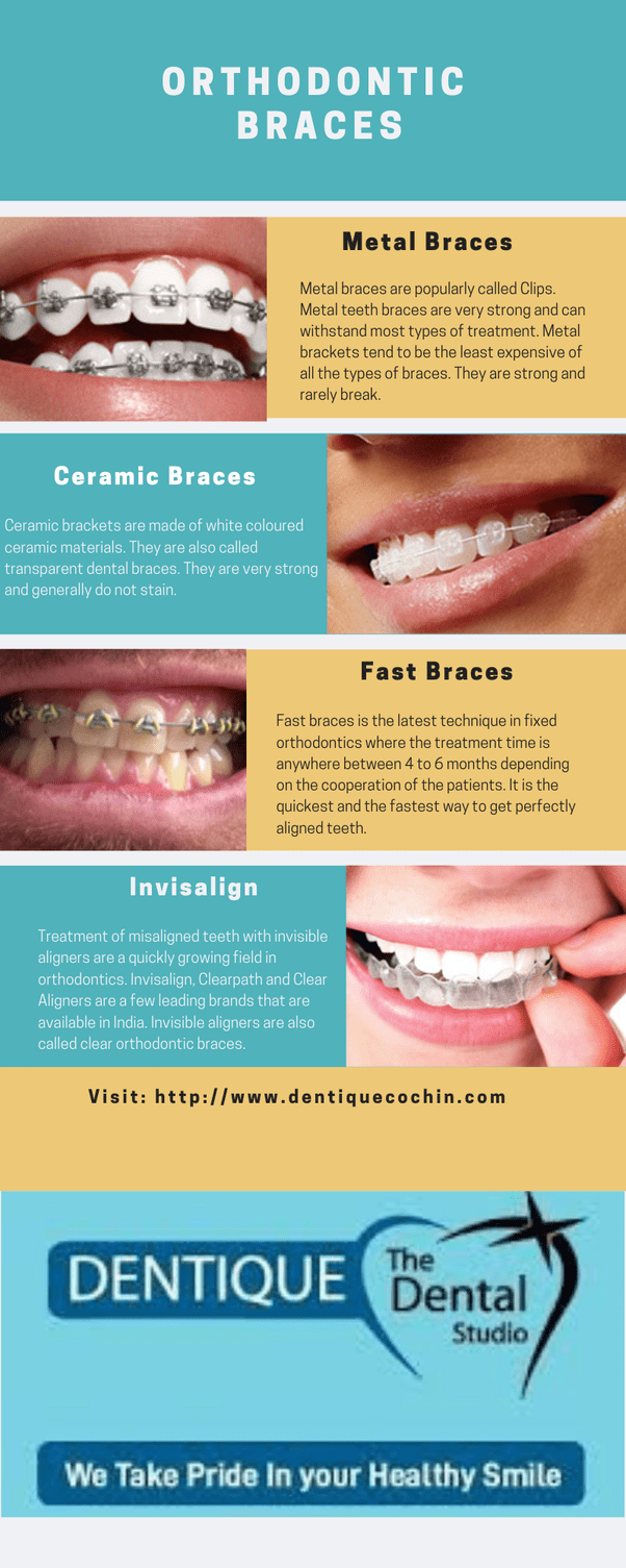 How Long Does it Take Invisalign to Straighten My Teeth?