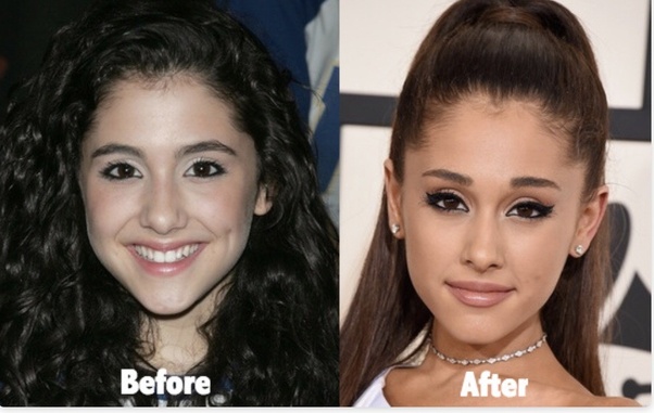 Can I change my round eyes to almondshaped eyes, without makeup? Quora