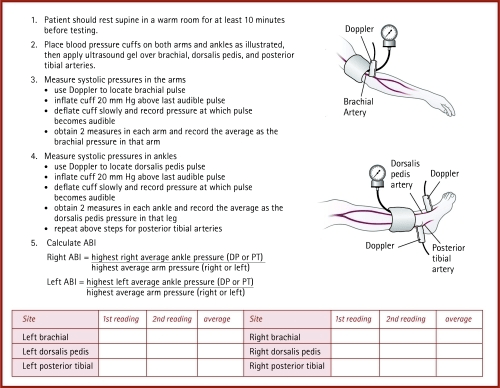 What can a high ankle brachial index mean? Quora