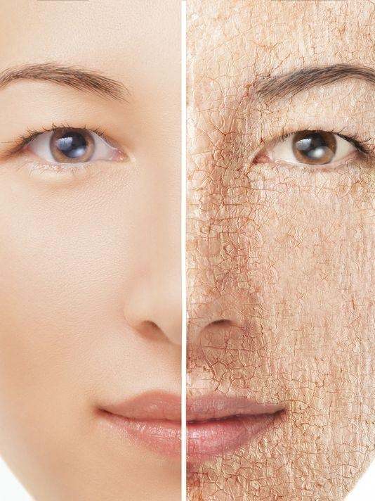 Dry Skin Face Treatment Doctor Heck
