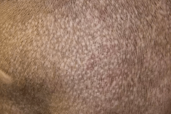 Are FUE scars repairable? Quora