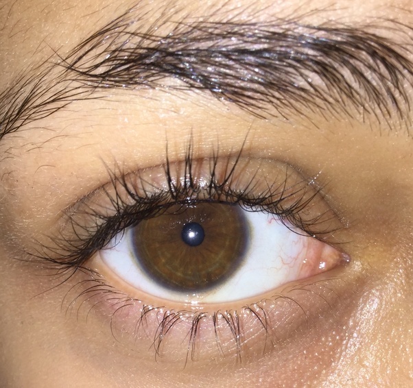 I have brown eyes and I have noticed that I have a blue ring around my