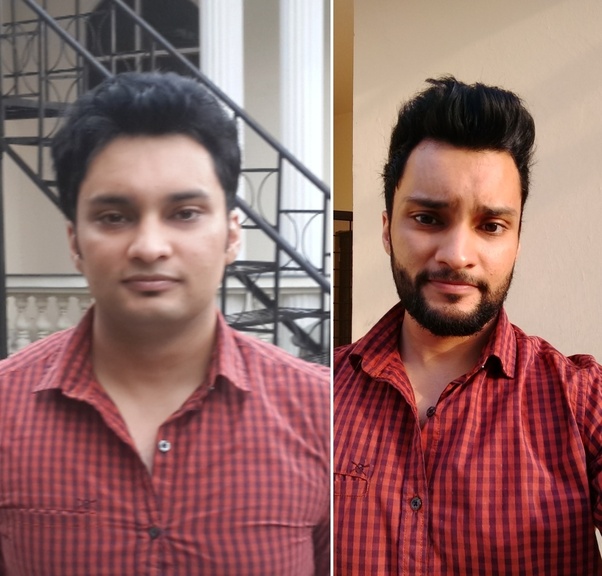 If you lose weight, does it change your face shape (i.e