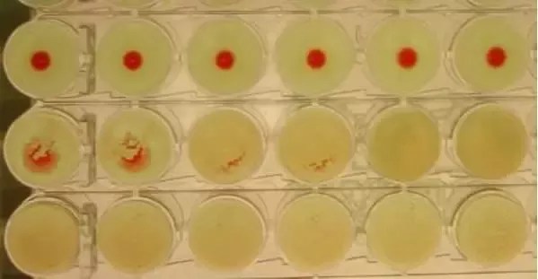 Apa perbedaan antara aglutinasi dan presipitasi dalam reaksi imunologi? -  Quora