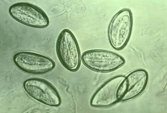 What is the cause of pinworm infection? Quora