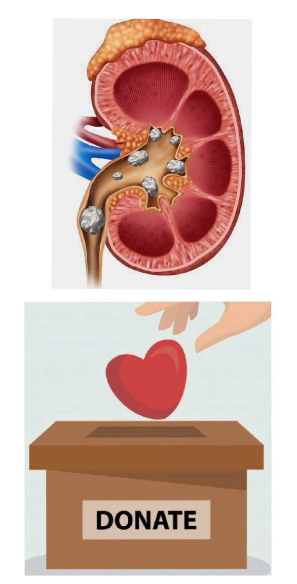 How Can I Donate A Kidney