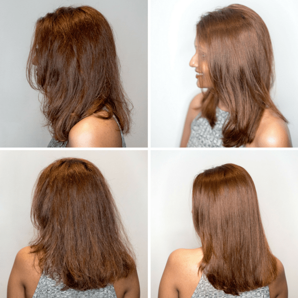 What is the most effective hair loss treatment for women