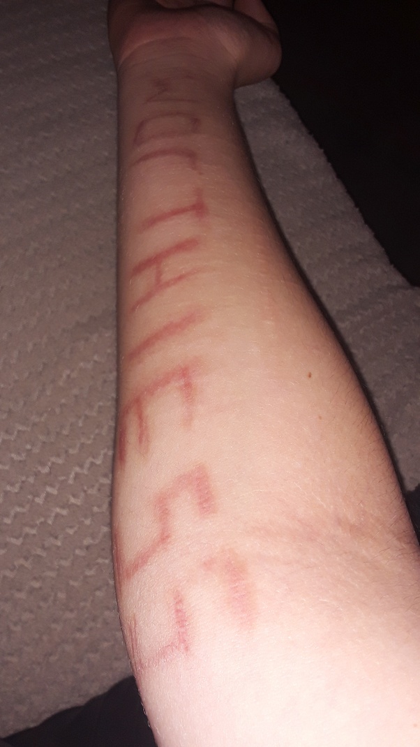 How To Cover Up Self Harm Scars On Legs With Makeup Makeup Vidalondon