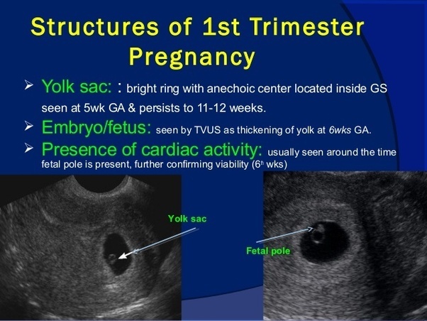 How soon can an ultrasound confirm your pregnancy? Quora