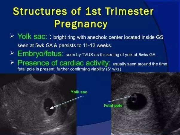 What Should Be Expected To See On A 1 Week Pregnant Ultrasound? - Quora
