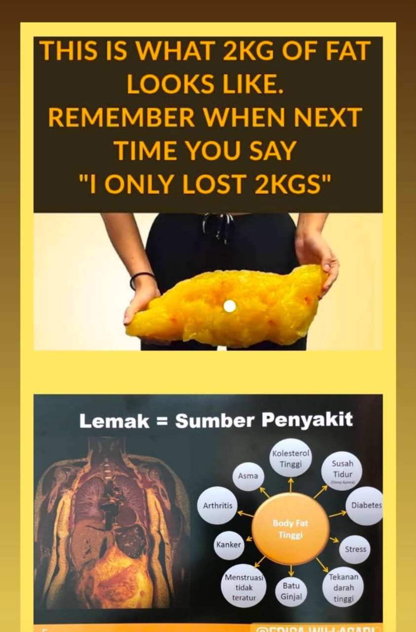 Apa pola makan terbaik untuk seseorang yang memiliki penyakit autoimun? -  Quora