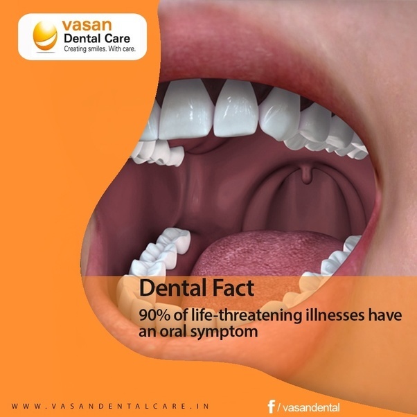 What is ozone therapy for teeth? Is it safe? Quora