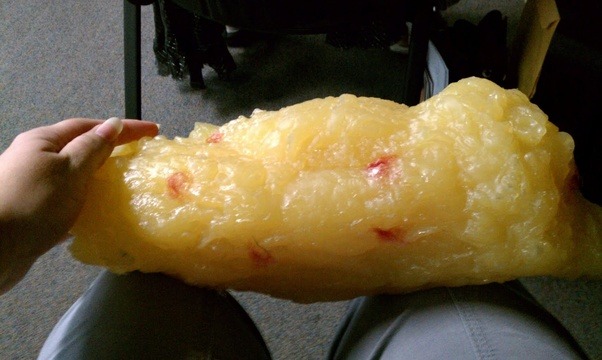 How to lose 30 pounds in 6 weeks without exercising Quora