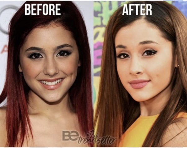 Can I change my round eyes to almondshaped eyes, without makeup? Quora