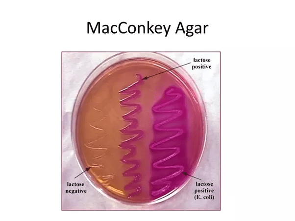 What is culture media in microbiology? Quora