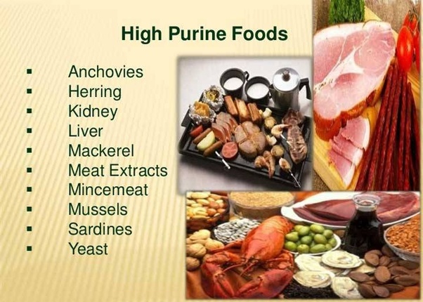 Are there any cures for a person suffering with uric acid? Quora