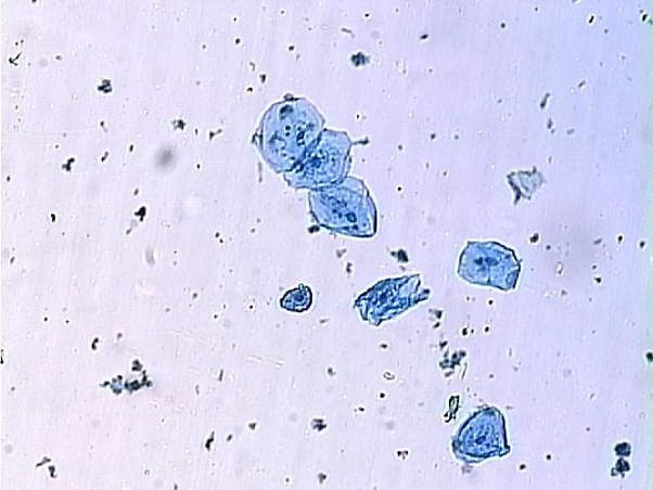 What is the shape of cheek cells and how can you find out the shape of