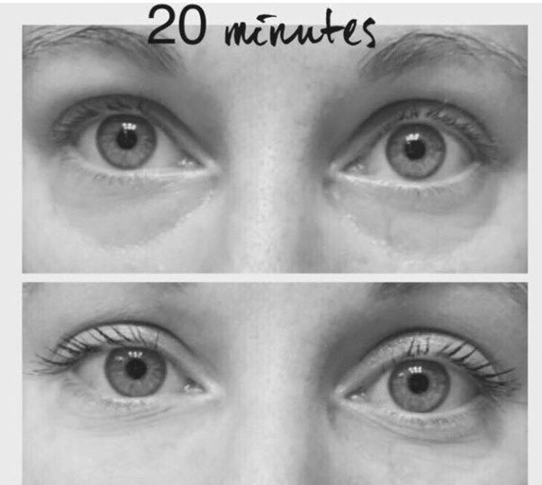 Which is the best Anti aging eye cream that repair wrinkles and