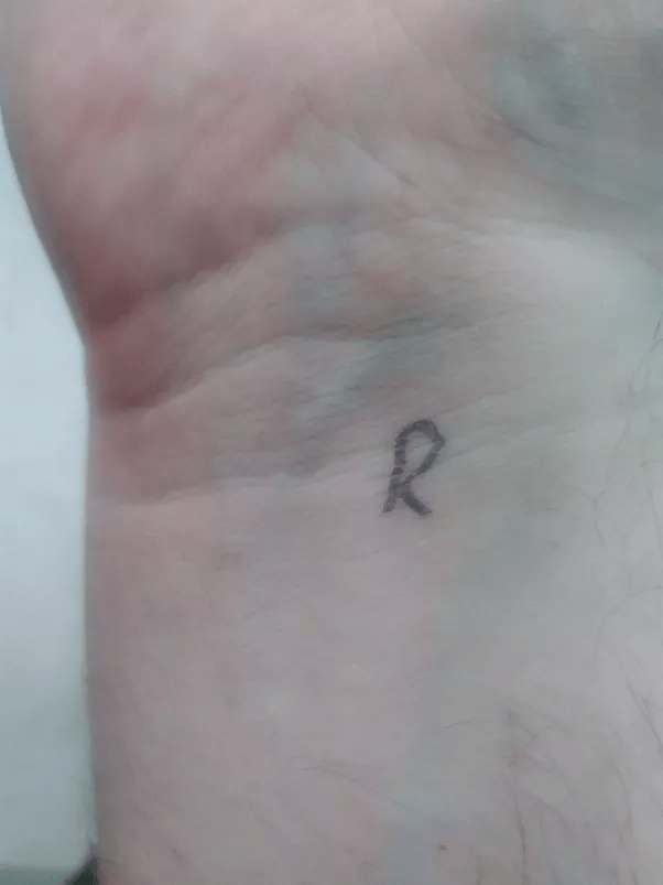 The veins in my right wrist are bigger, thicker and more pronounced