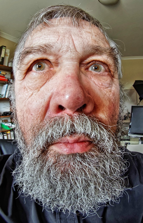 Why does my new front facing camera distort my face? My eye and lip are