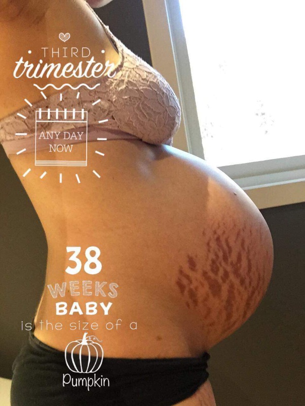 Can you share pictures of you before or during child birth? Quora