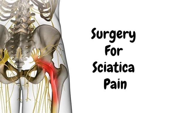 Can sciatica pain in the legs be cured by surgery? Quora