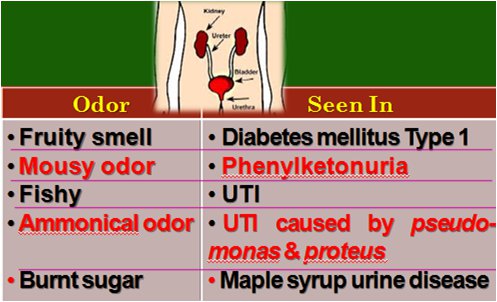 How To Prevent Bad Odor In My Urine - Quora