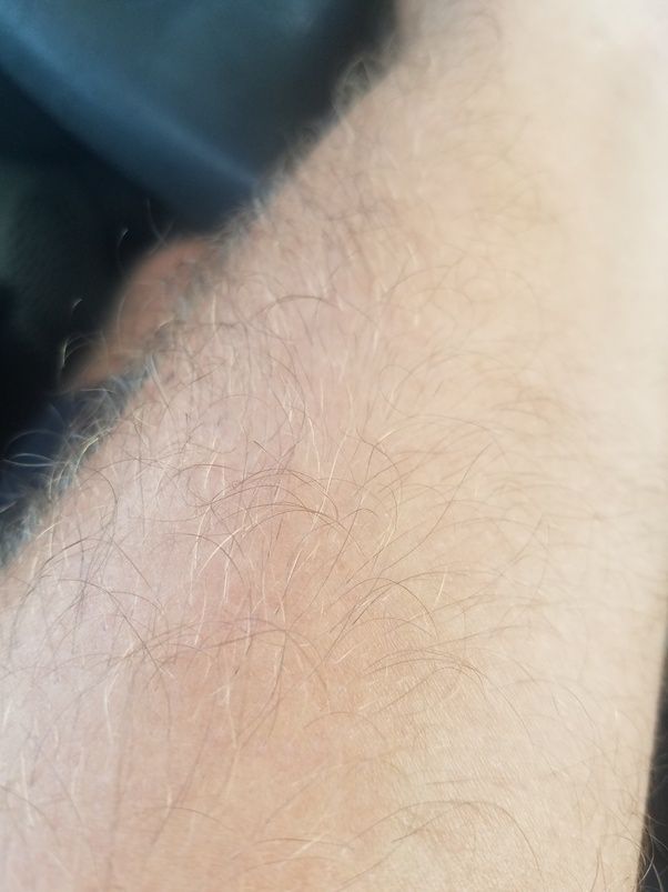 Does swimming pool water cause white hair? Quora