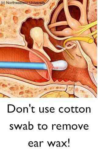 Would Itching Inside You Ear Canal With Your Finger Cause An Ear Infection? - Quora