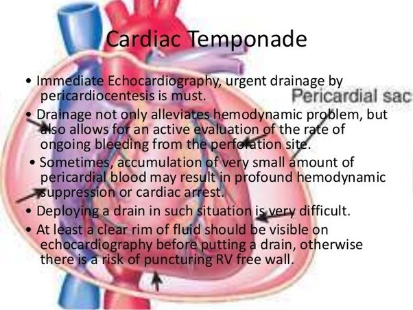 What are the complications of angioplasty with stenting? Quora