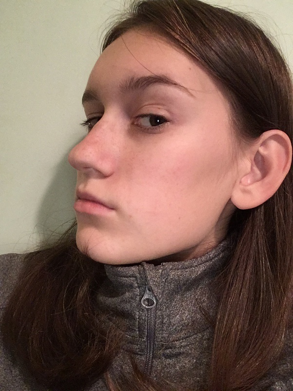 Do you like your nose? Quora