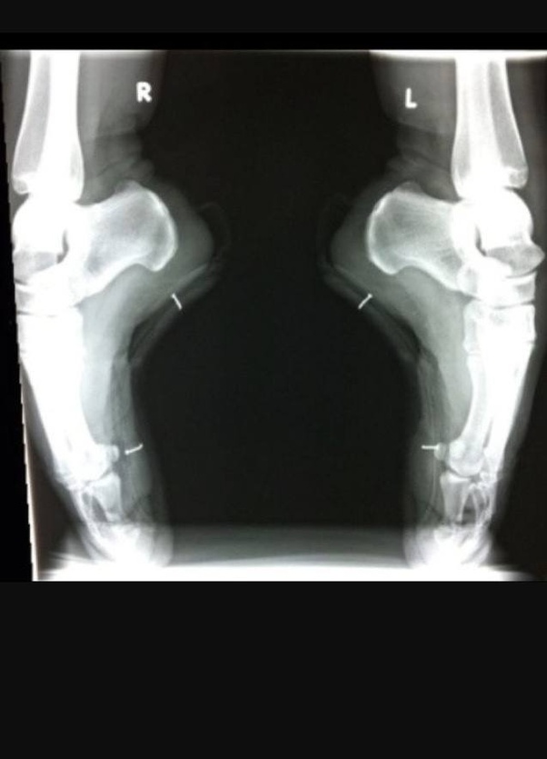 Why do ballerinas have such ugly feet? Quora