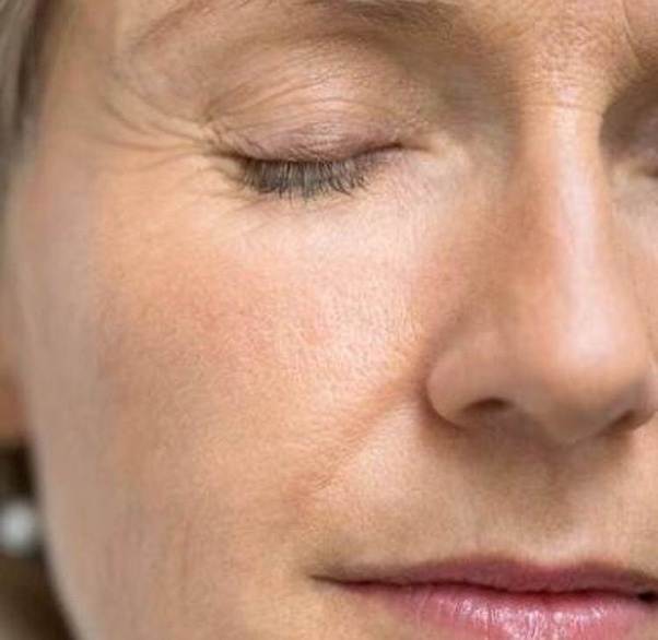 What causes fine lines and wrinkles to appear in the skin? Quora