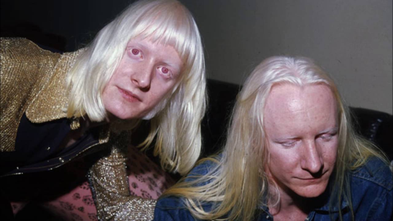 Pernahkah Anda melihat orang tua albino? - Quora