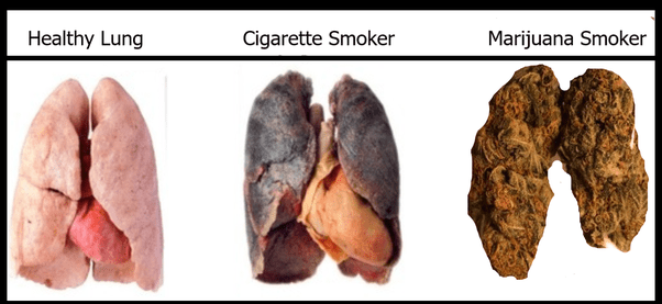 Will a smoker’s lungs clean themselves if they quit smoking and how