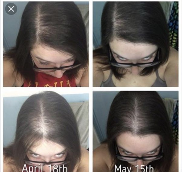 If you have split ends but want to grow your hair longer