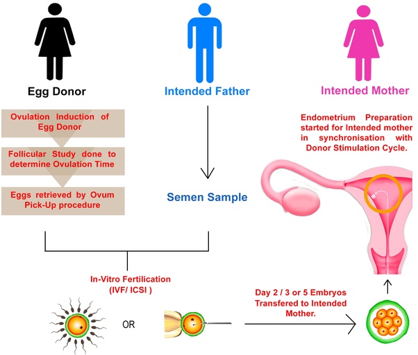 How long is the process of IVF? Quora