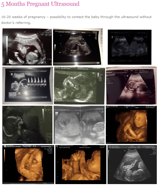 How should my belly look after 5 months pregnant? Quora