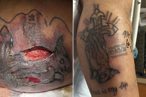 Quali Sono I Rischi Dei Tatuaggi? - Quora 409_x_615_jpg