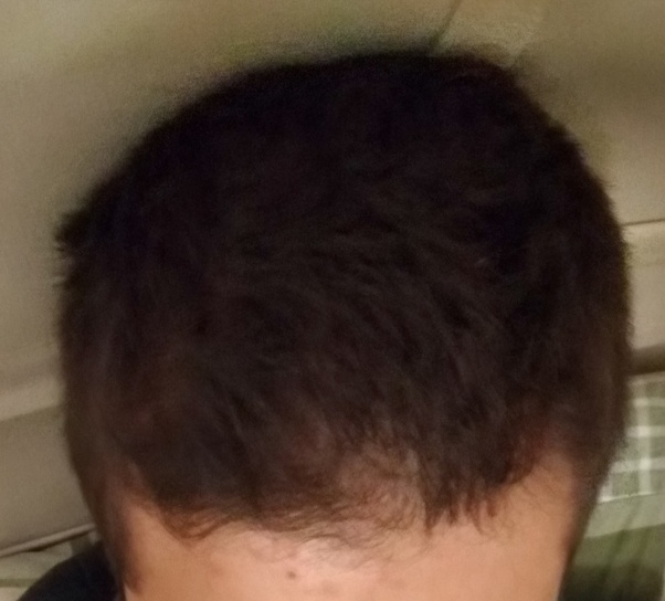 What is wrong with my hair? Quora