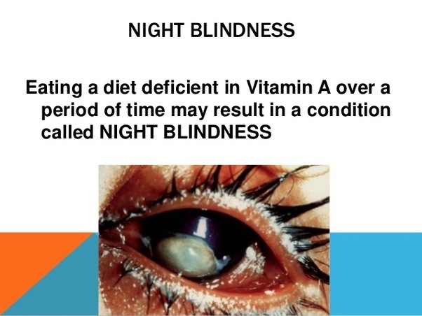 Night blindness is caused by the deficiancy of? Quora