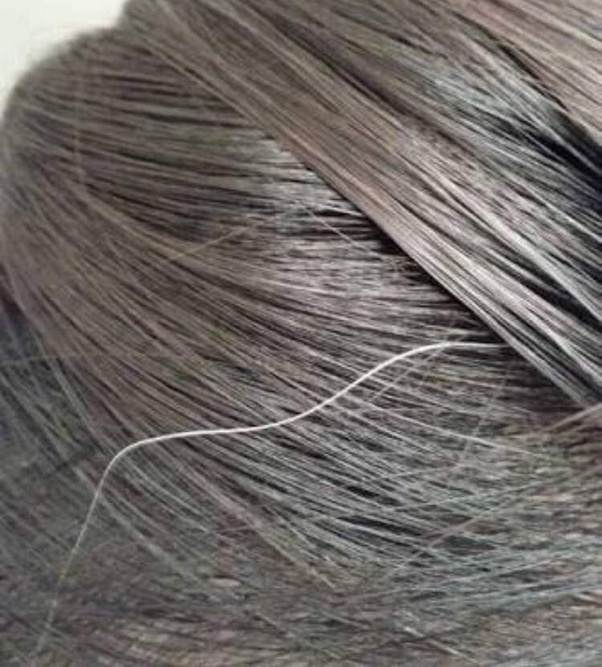 Why does hair turn grey in some teenagers? Quora
