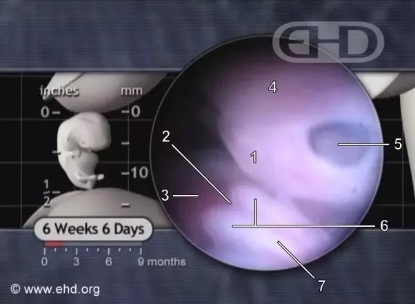 Can 3 tablets of Cytotec 200 micrograms pill abort a 6week pregnancy