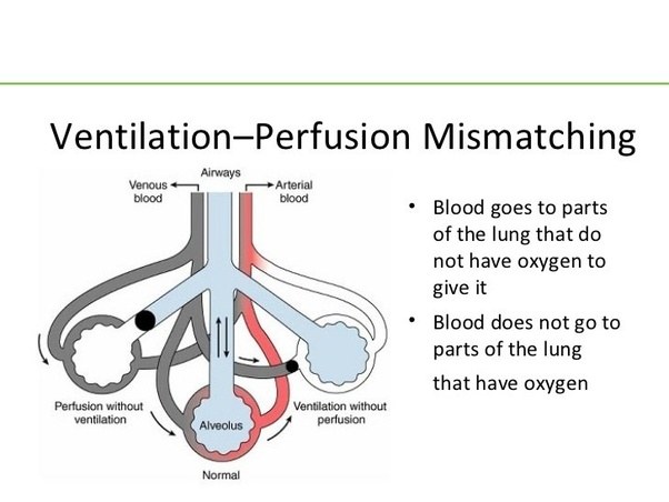 Chronic Obstructive Pulmonary Disease Meaning In Marathi Kronis g