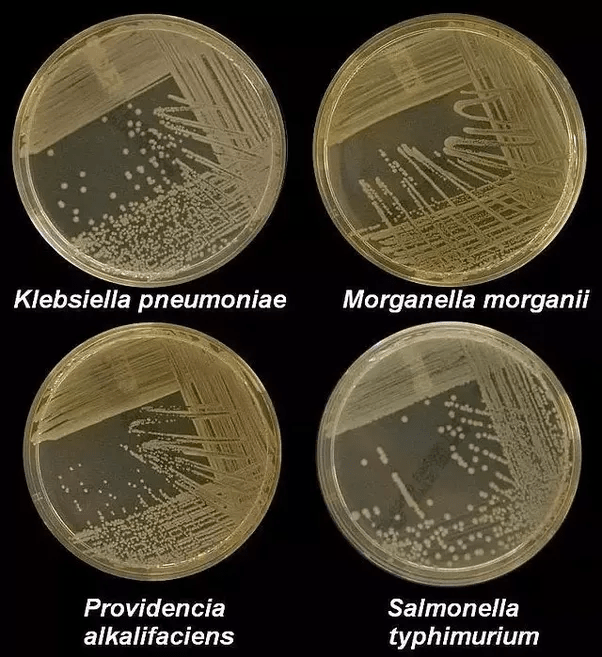 What is culture media in microbiology? Quora