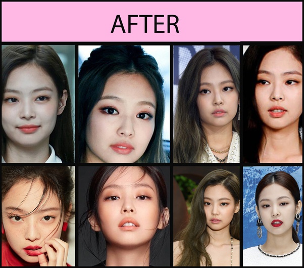 Did BLACKPINK get plastic surgery? Quora