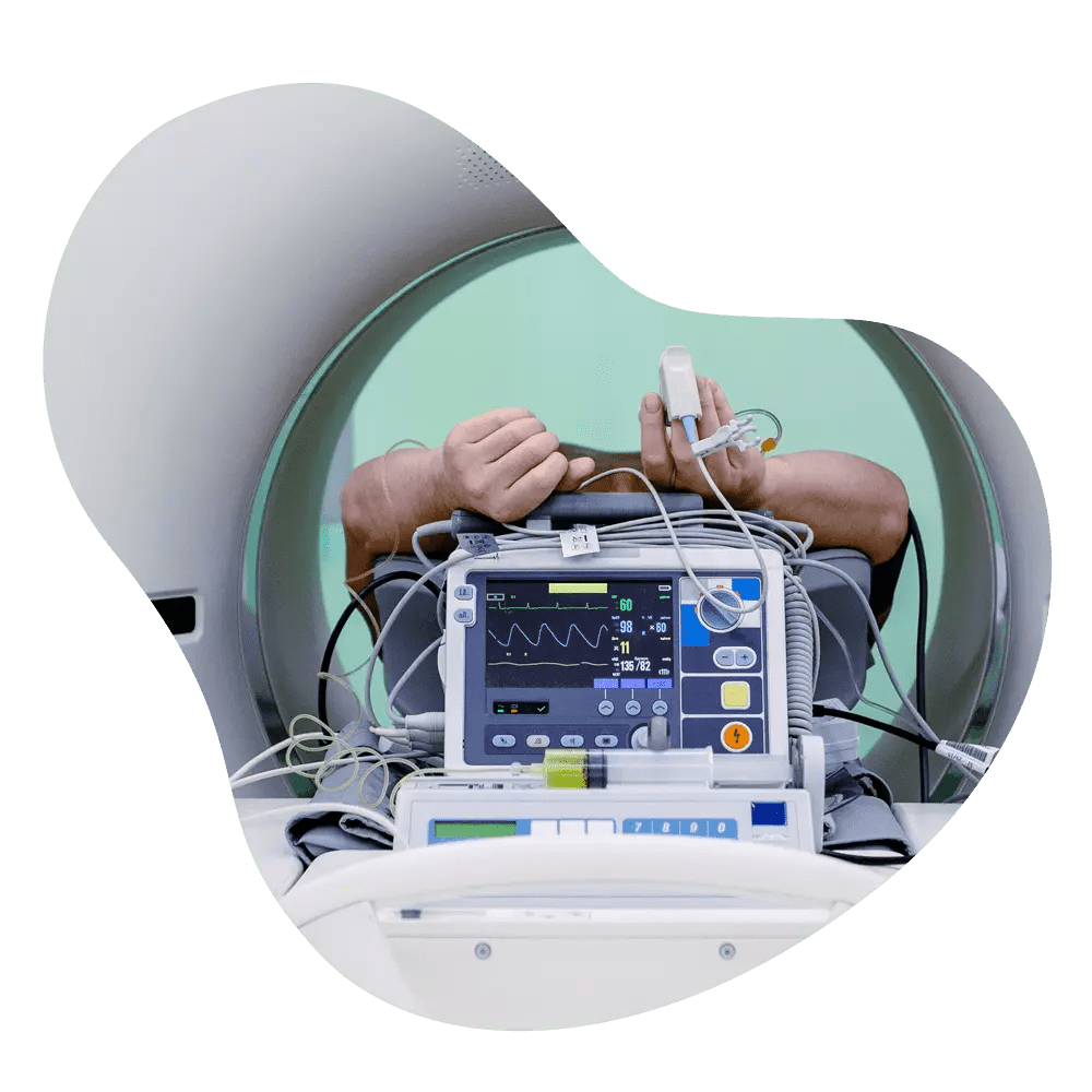 CT Angiography in Delhi, CT Coronary Angiogram Cost starting 1999