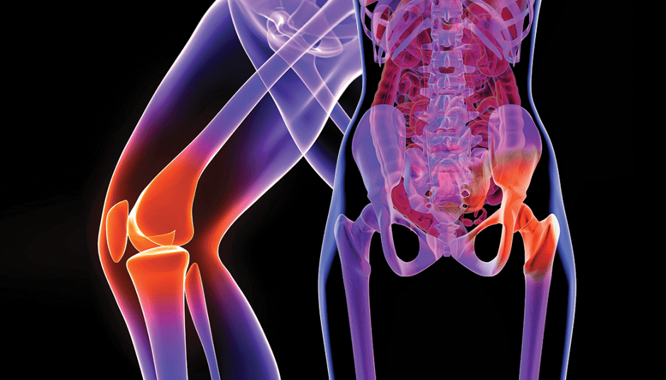Avoid Wait Times in Ontario Alternative Joint Replacement Surgery